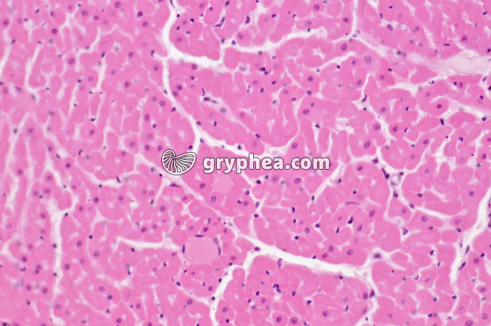 Mucle cardiaque CT x160 - gryphea.com